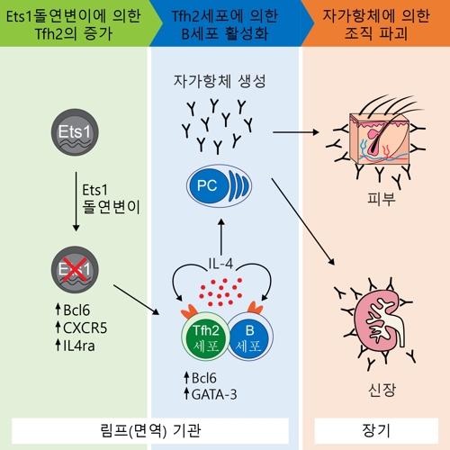 한국 연구진 '루푸스' 발병 원인 찾아내…공략법 제시