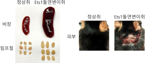 한국 연구진 '루푸스' 발병 원인 찾아내…공략법 제시