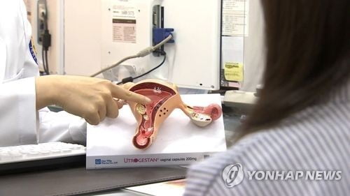 "국내 임신부 1000명당 17.3명꼴 자궁외임신"