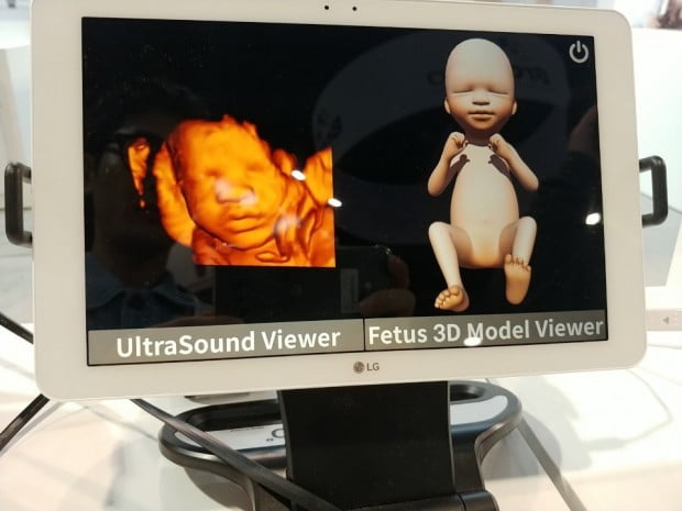[CES 2019] '눈앞에 있는듯'…VR로 태아 얼굴보며 교감한다(영상)
