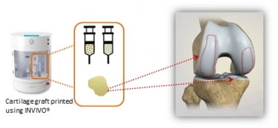 로킷헬스케어, 하버드의대 부속 병원과 3D프린팅 기반 연골재생치료 전임상 실시