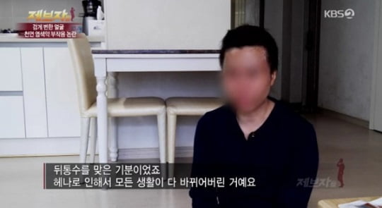 '제보자들' 헤나 염색 부작용...검게 변한 얼굴에 차도 없는 치료