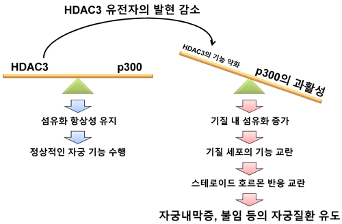 불임 유발 자궁내막증 정복 '한 걸음 더'