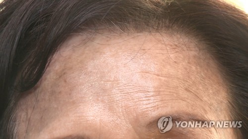 "헤나염색 피해 막으려면 '패치테스트' 하세요"…안내문 배포