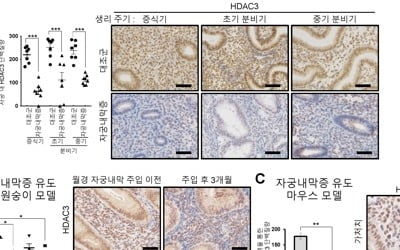 불임 유발 자궁내막증 정복 '한 걸음 더'