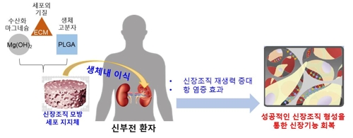 신장이식 대신 조직재생 유도…고분자물질 제작 성공