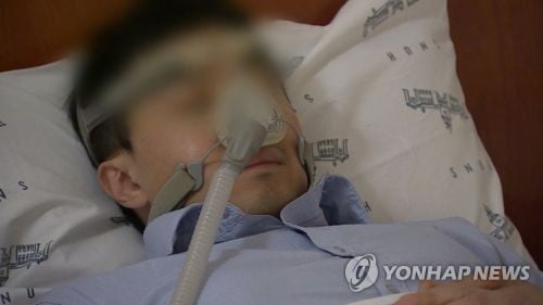 "코골이에 낮에 심하게 졸리면 심부전 위험 3배"