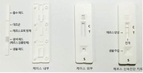 '메르스 감염' 20분 만에 진단한다…상용화 첫발