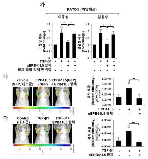 전이성 위암 발병 핵심인자 발견…치료법도 제시(사진=연합뉴스)