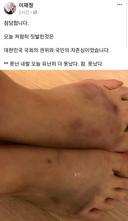 '난장판 국회'…육탄전 속 민주·한국 부상자 속출