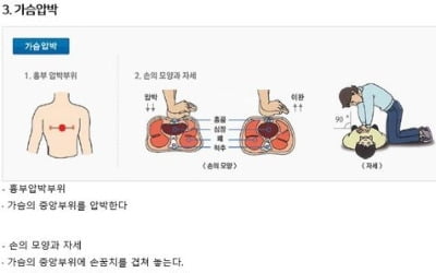 "심폐소생술, 가슴 압박만 해도 생존율 높아"