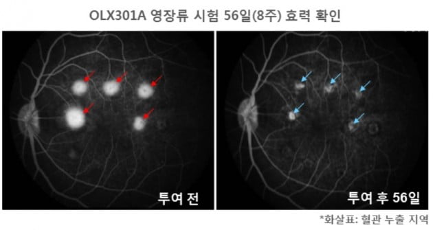 올릭스, 건·습성 황반변성치료제 영장류 시험서 효력 확인