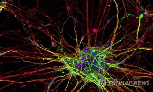 "컴퓨터 전기 신호로 뉴런 속이면 경화증 등 치료에 도움"