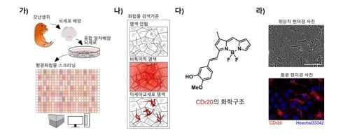 뇌 속 `청소 세포` 추적해 치매 잡는다?…새로운 연구 `주목`