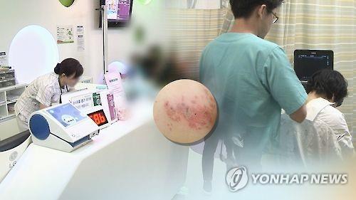 여름철 대상포진 주의보…"면역력 관리 필요"