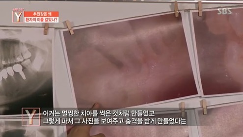 궁금한이야기 Y (사진=방송 영상 캡처)