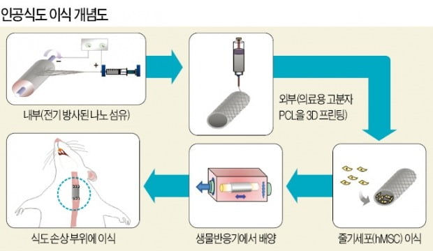 3D프린터로 만든 인공식도, 이식수술 길 열렸다