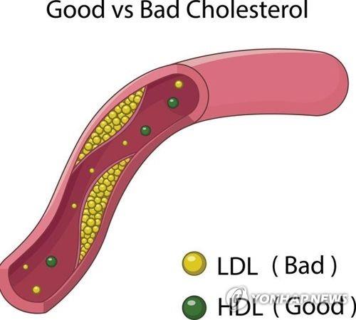 "'나쁜' 콜레스테롤 너무 적으면 뇌출혈 위험↑"