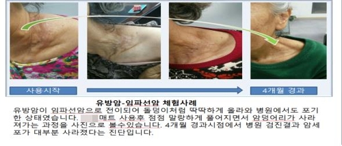 '암세포 사라져' 과장광고 앞세워 고가 침구 판 다단계업체 적발