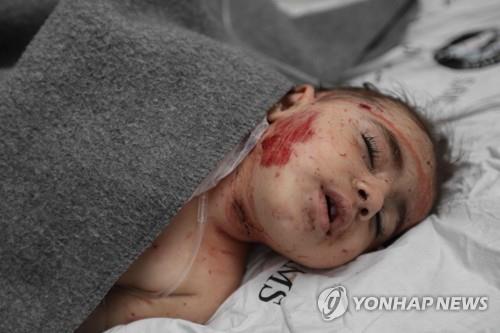 시리아 정부·러시아군 공습으로 어린이 등 14명 사망