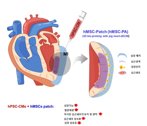 복합 줄기세포로 심근경색 치료…"심장 회복 규명"