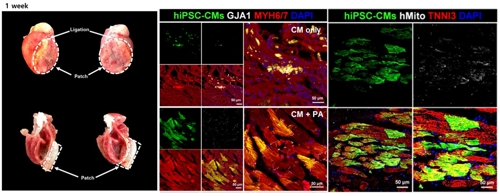 복합 줄기세포로 심근경색 치료…"심장 회복 규명"