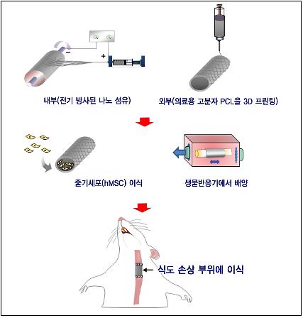 서울대병원, 동물실험서 '인공식도' 이식 성공