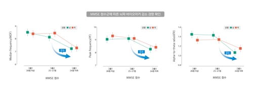 2시간 설문 대신 5분 뇌파 측정으로 치매 위험 포착한다