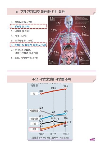 치주 질환이 어르신 폐렴을 유발할 수 있다?