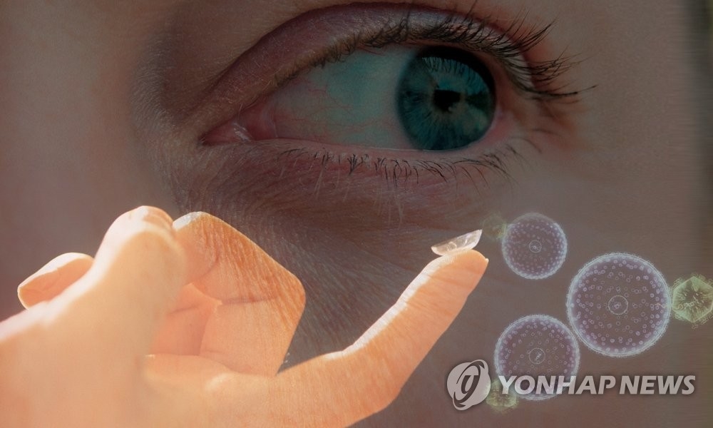 휴가철 피서지, `렌즈 끼고 물놀이` 절대 안되는 이유