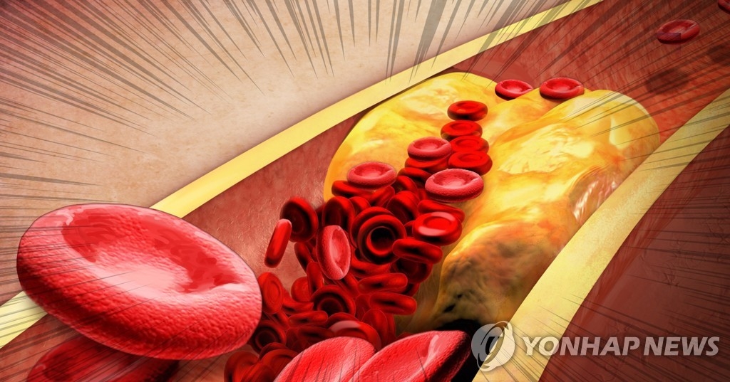 "`저녁형 인간`, 신체리듬 무너진 것…심뇌혈관질환 위험↑"