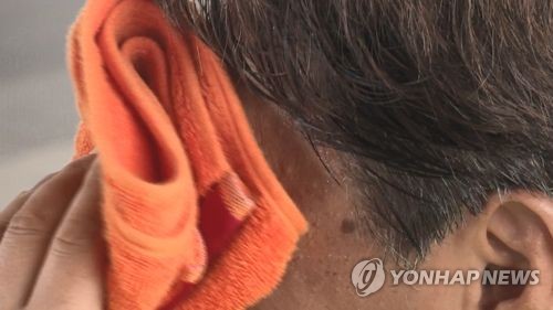 [위클리 스마트] 여름철 짜증 나게 하는 '땀'…그 속에 건강정보 있다