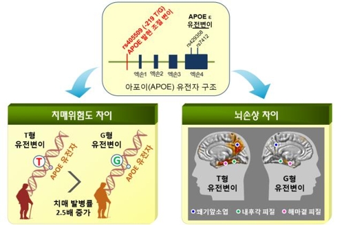 "한국인 치매에 취약"…조선대, 치매 유발 유전변이 분포 규명