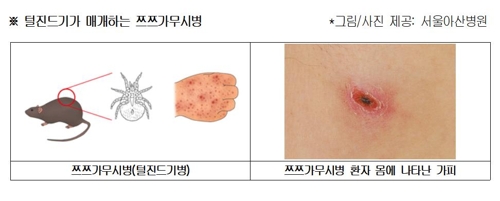 추석 앞둔 벌초·성묫길…"진드기·벌·뱀 조심"