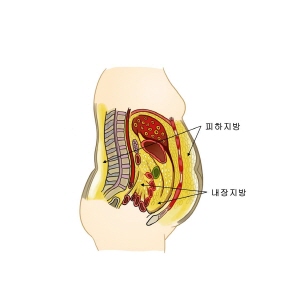 "내장지방, 남성보다 여성에 더 나쁘다"