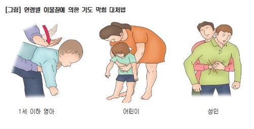 송편 먹다가 기도 막혔을 때 필요한 `하임리히법`