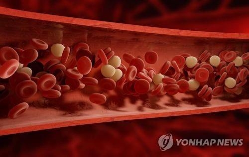 옥스퍼드대 연구팀, 비만-심장병 연관성 규명…"동맥혈관 직접 손상시켜"