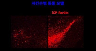 셀리버리, 미국신경학회서 파킨슨병 신약 'iCP-Parkin' 연구결과 3건 발표