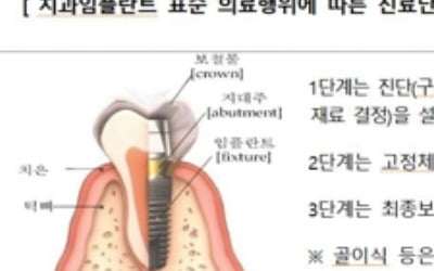 건강보험 적용 치과임플란트 불만 증가세…'부작용 발생'이 최다