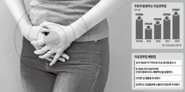 [이지현 기자의 생생헬스] 2030 꽁 머니 카지노 환자 증가…초기증상 거의 없어 2년마다 검진 필수