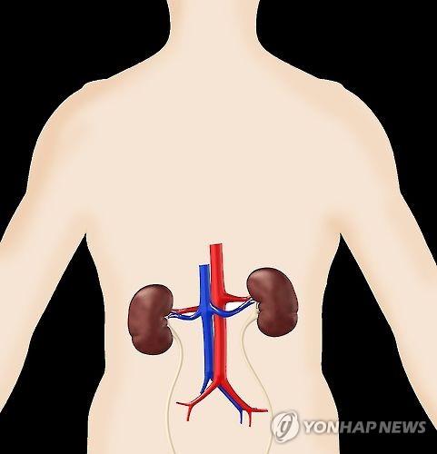 "신장병 환자, 근육 이완제 바클로펜 사용 신중해야"