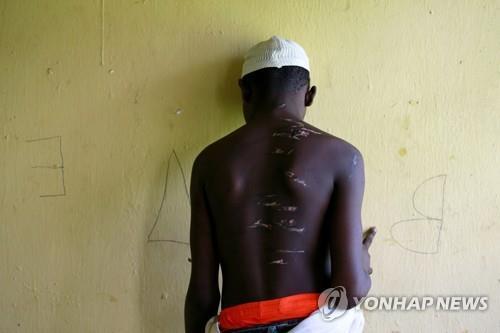 국제인권단체 "나이지리아, 정신건강 환자들에 대한 학대 만연"