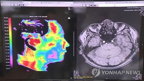 '뇌출혈 영상, AI가 판독'…SK C&C-아주대의료원 공동연구 협약