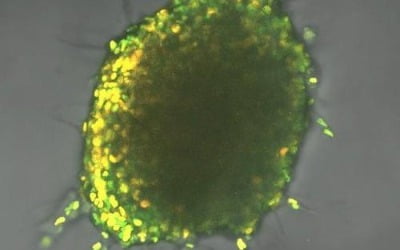 "암 사망의 주범 '암 줄기세포', 표적 공격 가능해졌다"