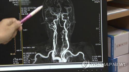 "집속초음파로 혈뇌장벽 개방…치매 치료에 도움 될 수도"