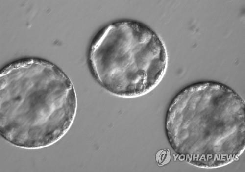 "유전 정보 없는 '정크 DNA' 변이도 암 위험 키운다"