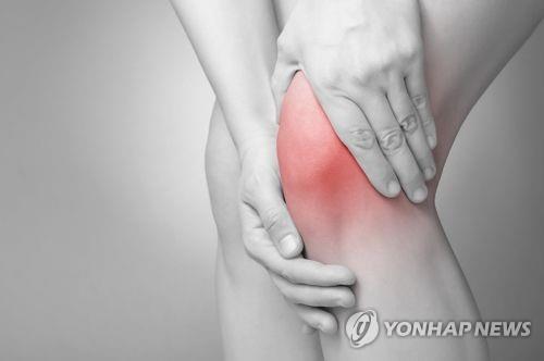 "무릎 관절염 통증 해결 방법은 신생 무릎 동맥 폐쇄"