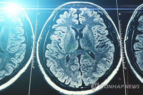 단순 두통에 MRI 땐 본인부담률 80%로 상향…내년 3월 시행