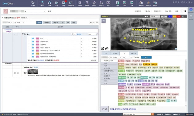 오스템임플란트, AI 적용한 치과용 전자차트 '원클릭' 출시