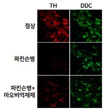 도파민 분비 신경세포 잠재우는 파킨슨병 유발 물질 찾았다